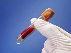 病毒血清学检测的实验方法