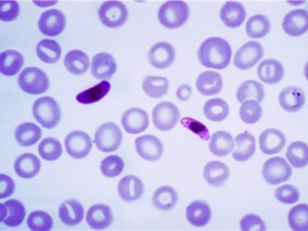 抗疟疾的新突破——新药和新疗法
