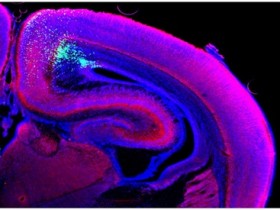 【免疫荧光】技术全解—染色篇