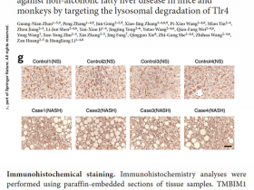 喜讯:Abbkine产品再次荣登国际顶级杂志《Nature Medicine,IF=30.357》