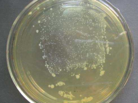 酵母感受态细胞的制备和保存