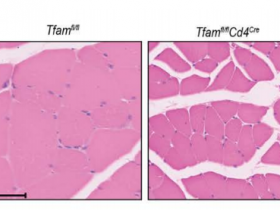 不是吧?T细胞异常会加速衰老?维C可提高T细胞杀伤作用?