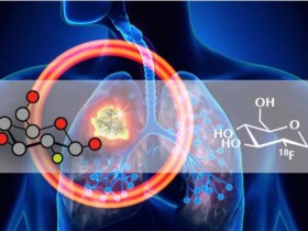 葡萄糖代谢研究——葡萄糖摄取分析试剂盒来了!