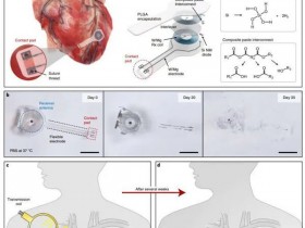 Nature Biotechnology:新型无线无电池完全植入式可溶解心脏起搏器